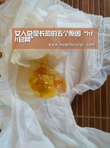 女人总是长斑的五个原因“hth官网”(图3) hth官网